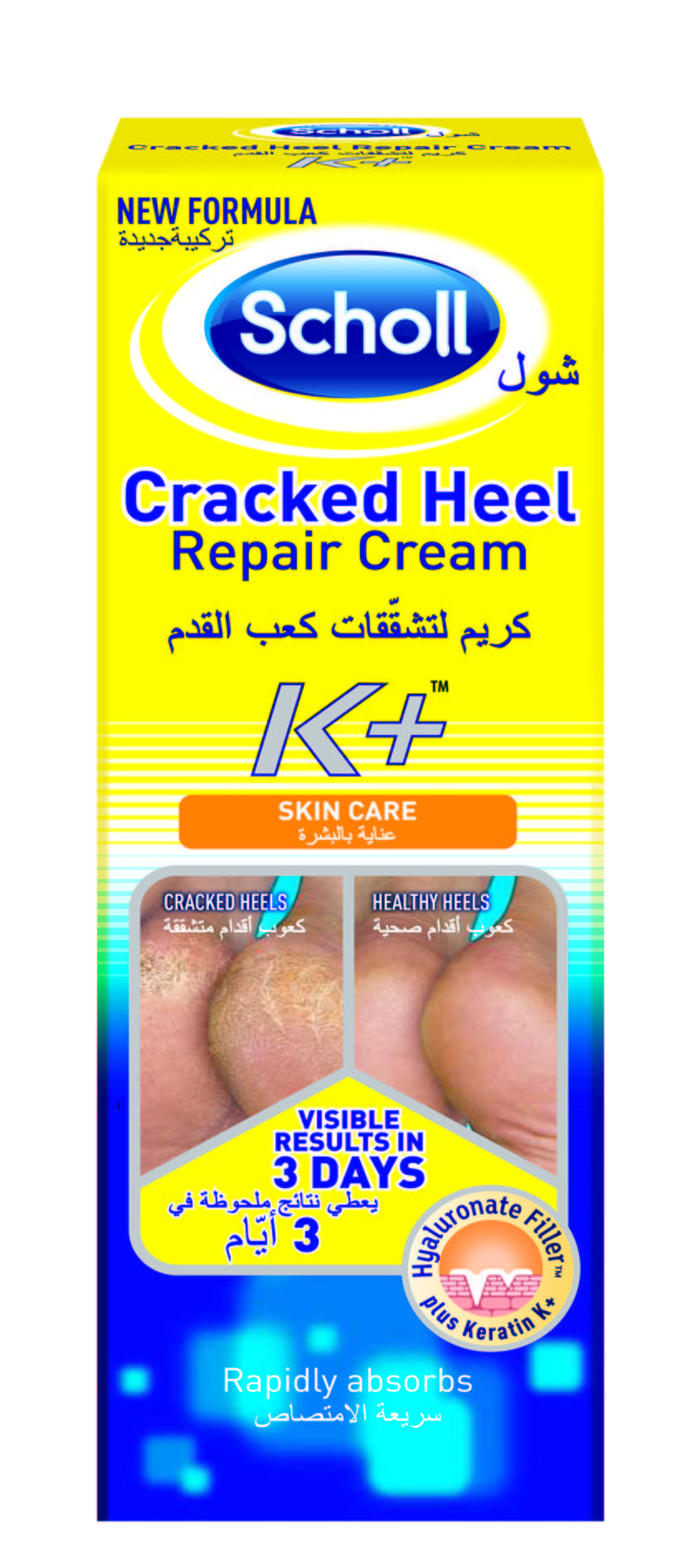 home remedies to remove bags under eyes